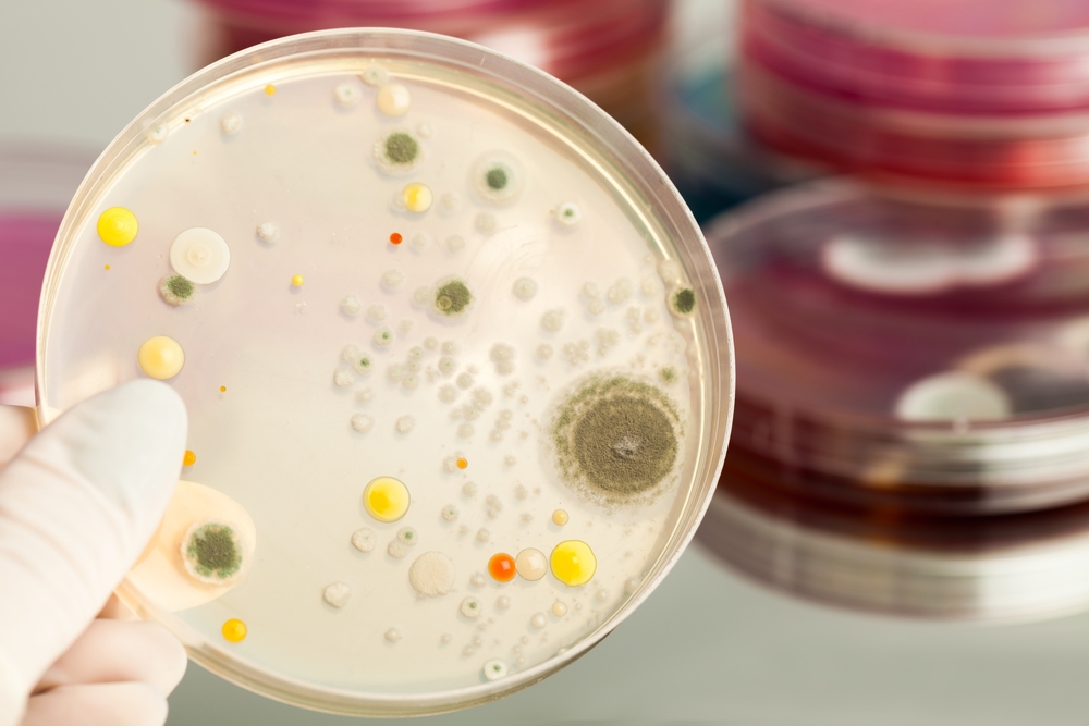 The Agar Art Competition